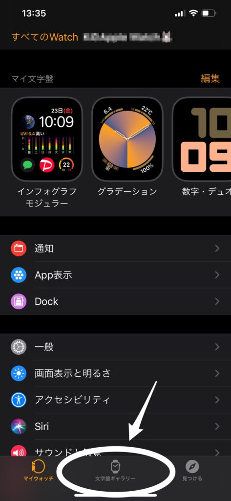 IMG 6584 1 Apple Watch